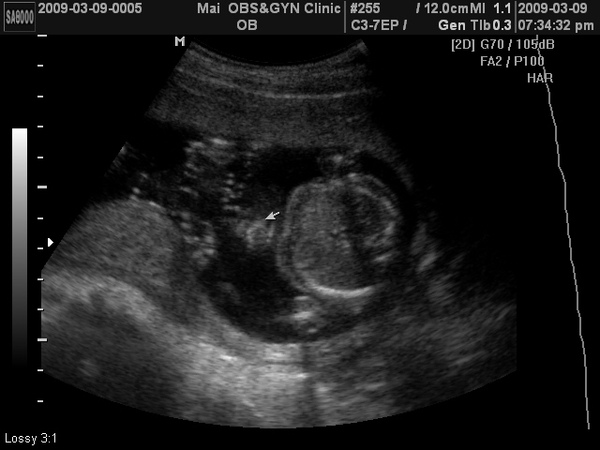 BABY2009-3-9_3.JPG