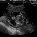 BABY2009-3-9_4.JPG