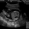 BABY2009-3-9_6.JPG