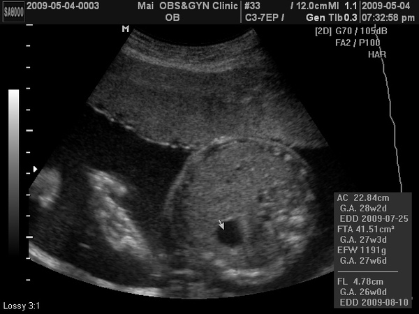 BABY2009-5-4_4.JPG