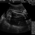 BABY2009-6-1_9.JPG