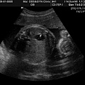 BABY2009-6-1_8.JPG