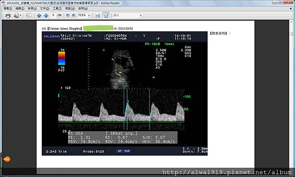 高層次超音波檢查-子宮動脈波長.jpg