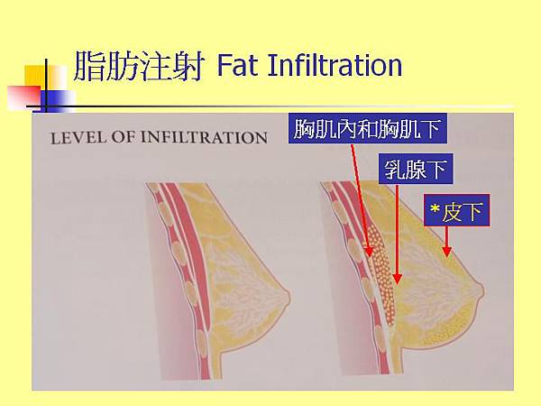 投影片43