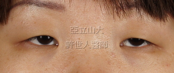 1a +眼尾-2.jpg 1a +眼尾-2.jpg