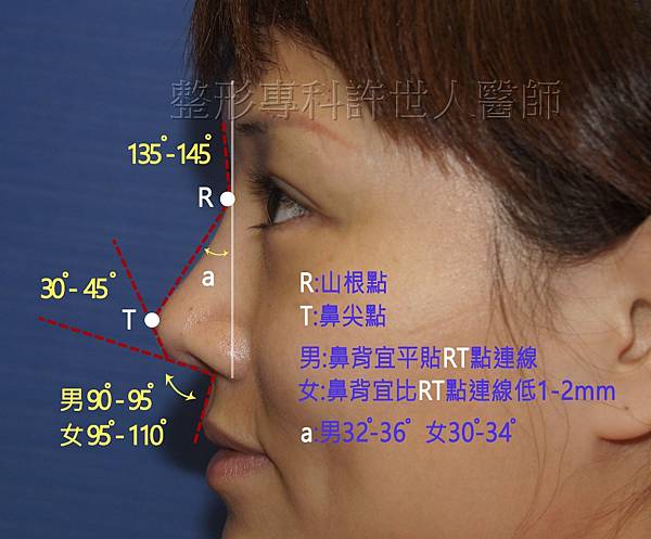 側鼻-1-4-2(近)a 浮.jpg 側鼻-1-4-2(近)a 浮.jpg