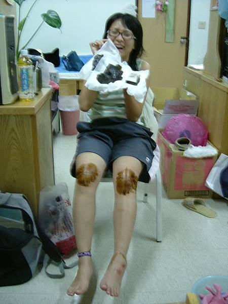 受傷還是笑開懷