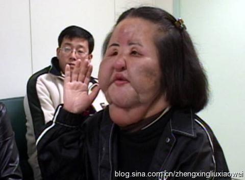 赴韓整形失敗的思考 醫美整形資訊相關知識分享版 赴韓整形失敗的思考 醫美整形資訊相關知識分享版