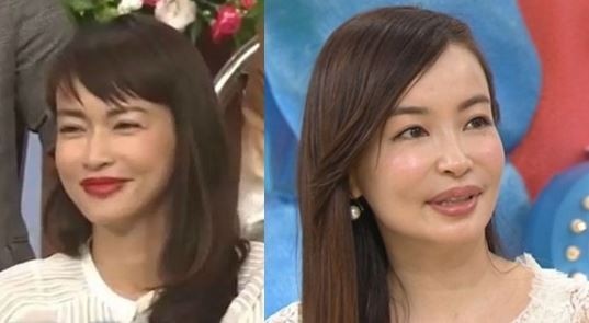 花心老公偷吃女星整形救婚姻被虧 醫美整形最前線 痞客邦 花心老公偷吃女星整形救婚姻被虧 醫美整形最前線 痞客邦