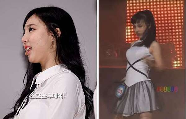 Twice娜璉被爆整形鼻子有蹊蹺 醫美整形最前線 痞客邦