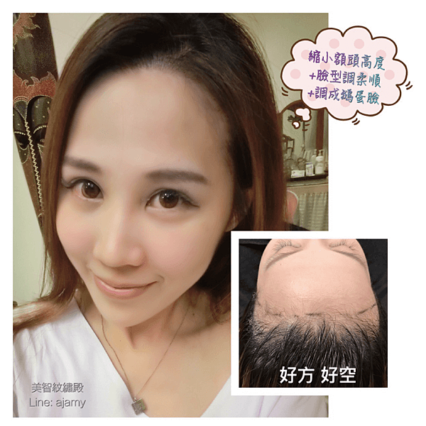 bald-hairline-how-to-do-39.png