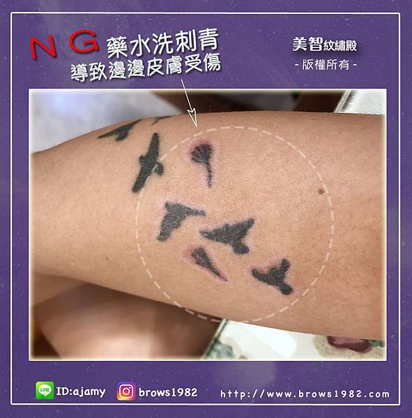 ＮＧ的藥水容易使肌膚受傷！