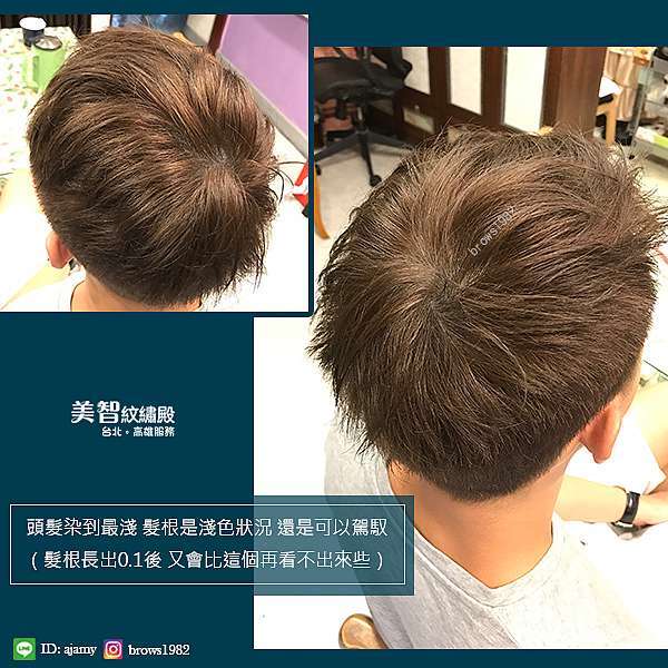 男仕髮際線專區 線頭頂中空怎麼辦 髮旋很大 男生m型禿怎麼補救 男生禿頭怎麼辦 美智紋繡殿 幫您創造完美髮際線