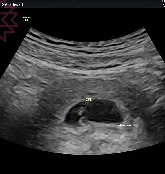 S__84074506 拷貝.jpg S__84074506 拷貝.jpg