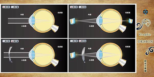 ．作品名稱｜寶島眼鏡眼球繪製解說圖