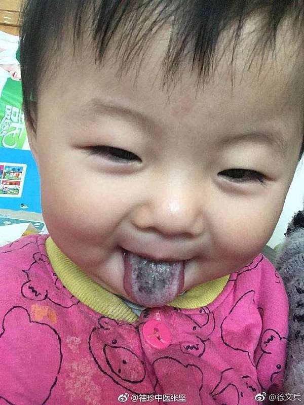 西醫 主流醫學 的昨是今非 Angela102的部落格 痞客邦