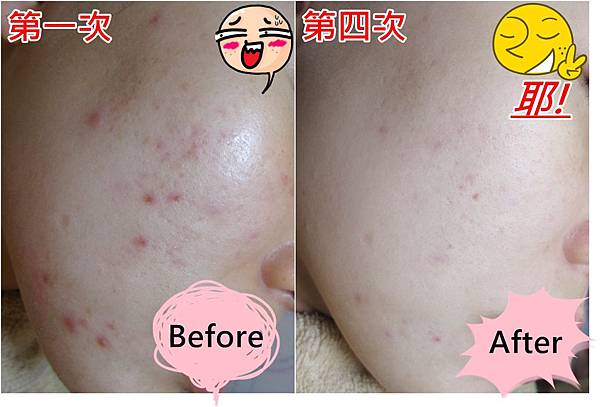 第1次-第四次(插圖)