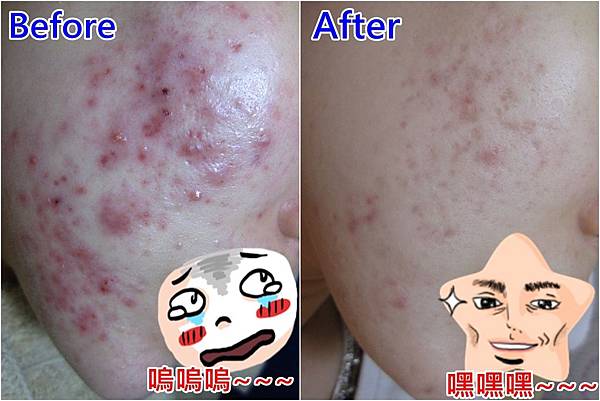 最糟糕-最好(有插圖)