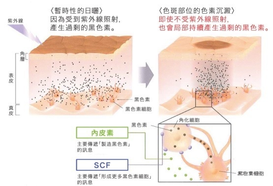 黑色素