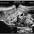Q寶22W+3D高層次超音波照片_正面器官照.jpg
