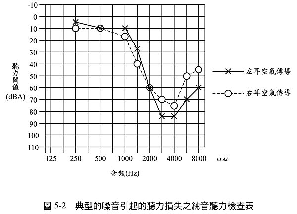 聽損