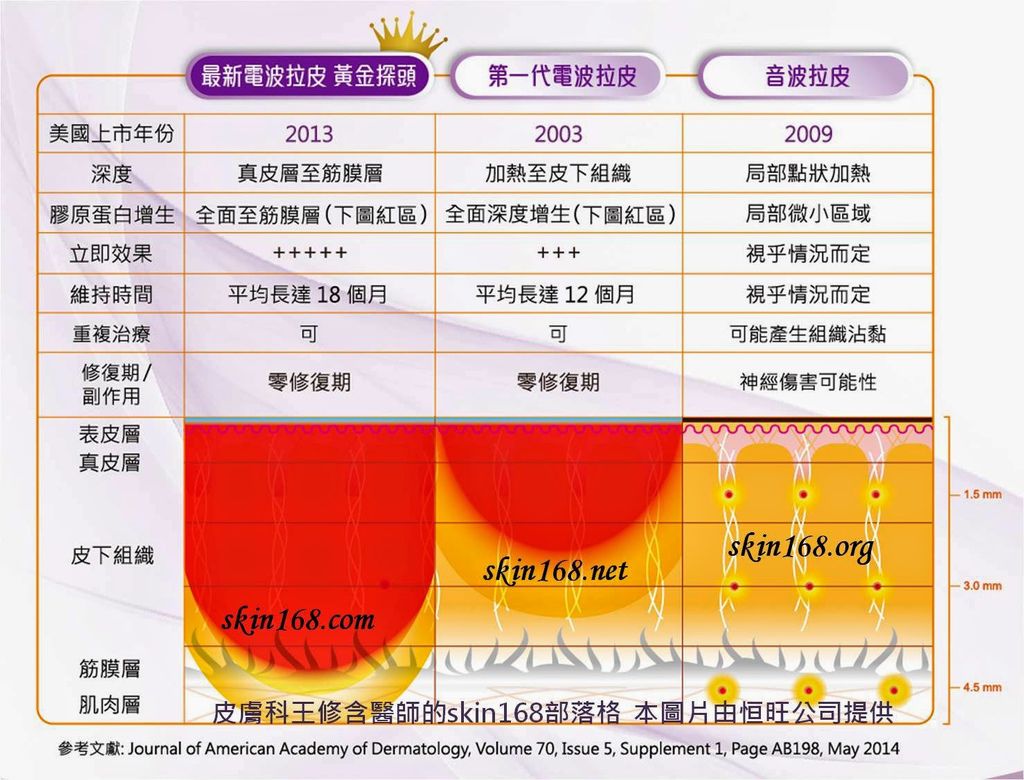 王修含皮膚科診所-皮膚科王修含醫師-Thermage電波拉皮vs音波拉提比較圖.jpg