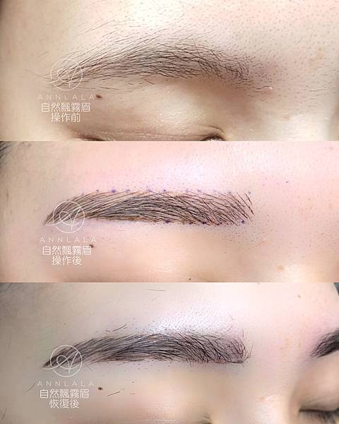 Annlala Beauty 自然飄霧眉 操作前後 & 恢復後  (4).JPG