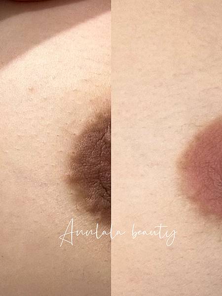 [美胸]花瓣乳暈美胸，少女粉嫩色系不是夢｜乳暈粉嫩｜乳暈淡化