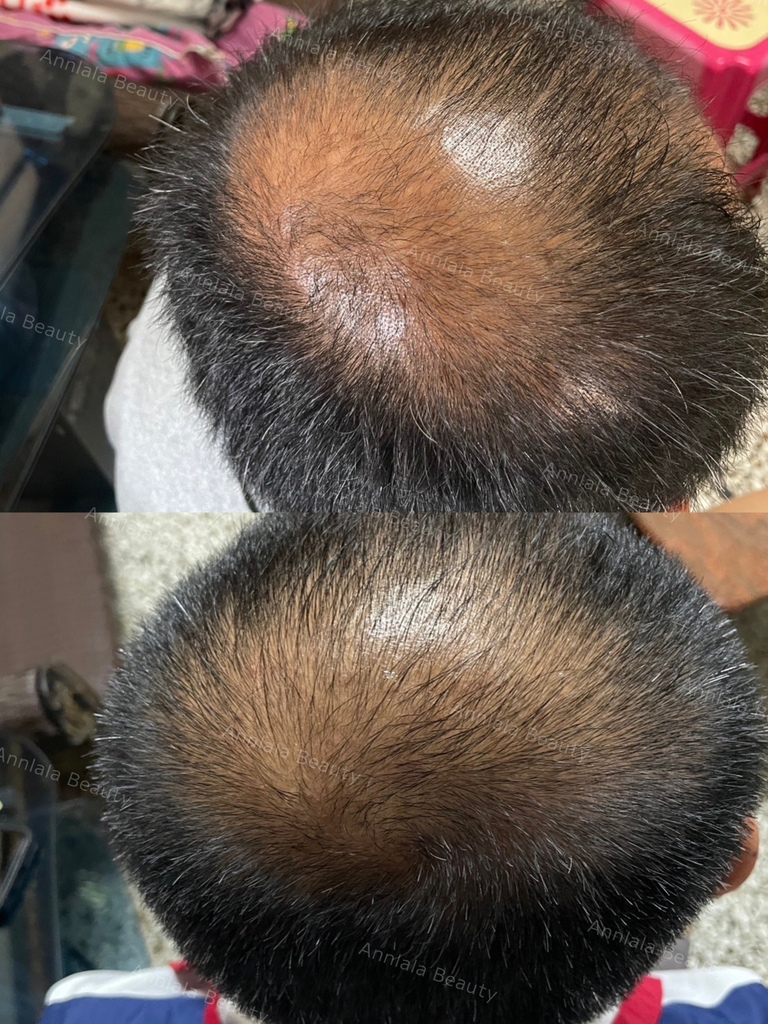 Annlala Beauty 外泌體 (21).JPG