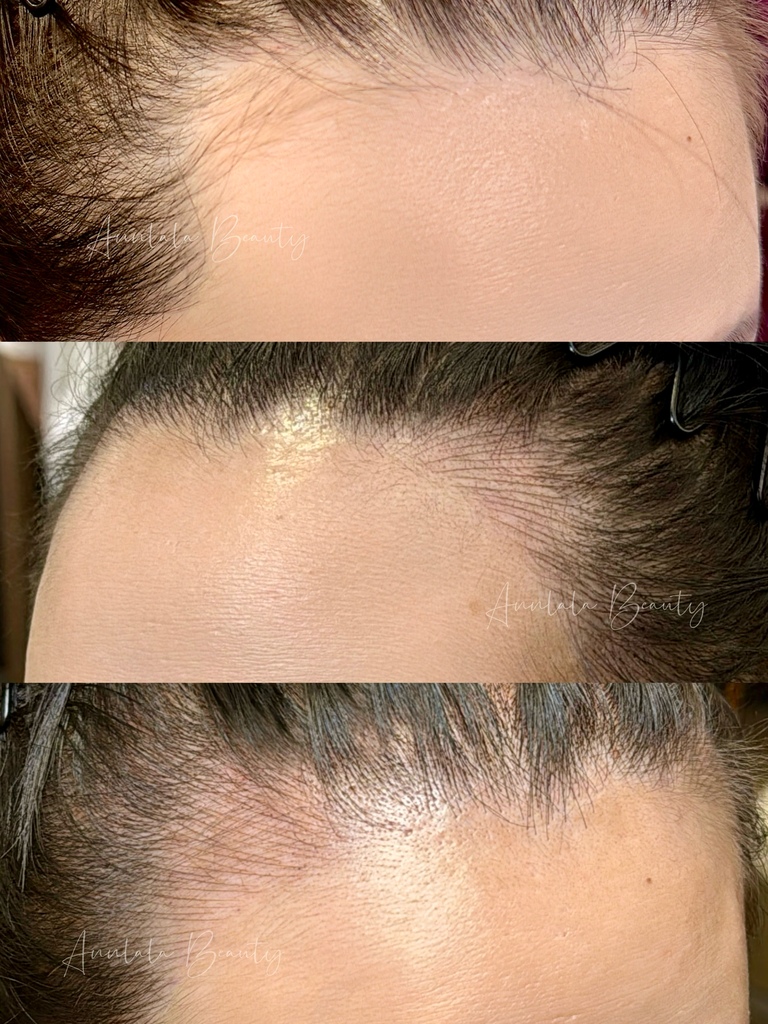 Annlala Beauty 髮際線 (5).jpg