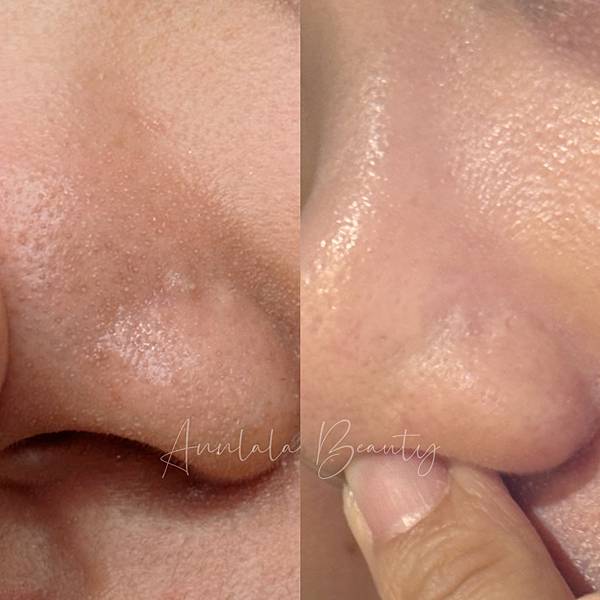 Annlala Beauty 水飛梭保水課程 (1).JPG