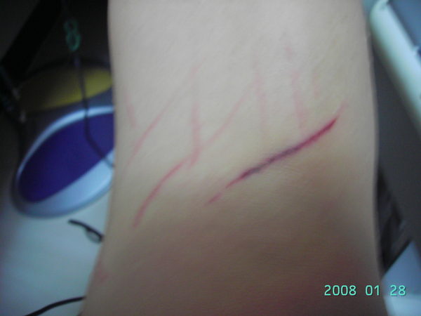 如果被野猫抓伤了 千万要记住这三点 关键时候可以救你一命 快资讯