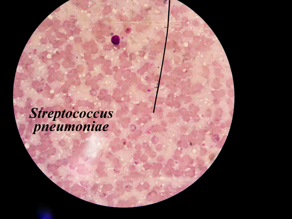 實驗19 - 肺炎鏈球菌