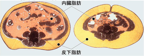 內臟脂肪及皮下脂肪CT.png