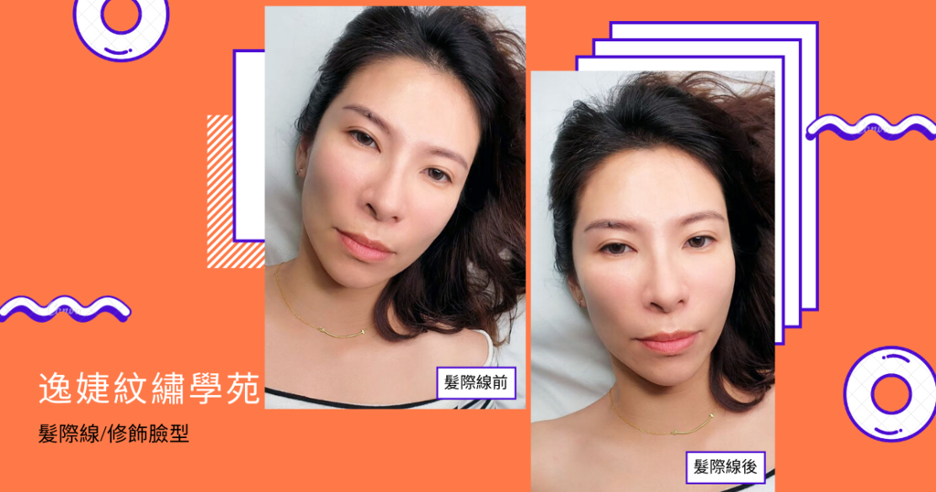 【台南紋繡】逸婕紋繡學苑/快速拯救髮際線/口碑師資精湛技術/修飾臉型調整比例/還原濃密髮根