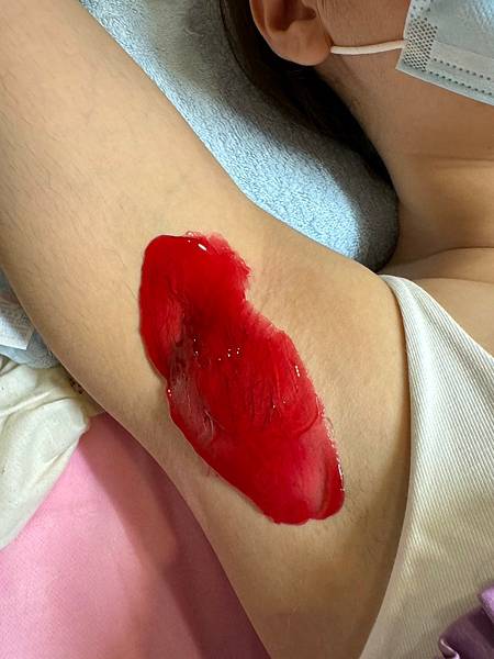 LINE_ALBUM_2024529腋毛熱蠟脫毛_240617_3.jpg