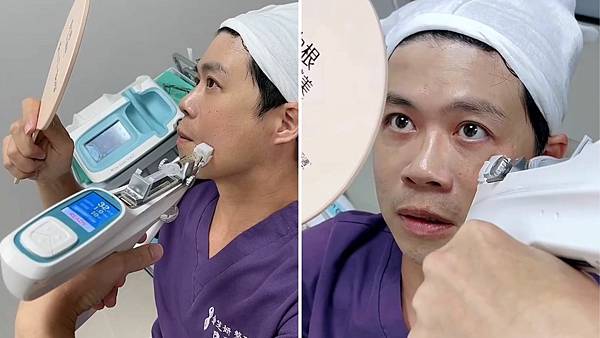 中胚層療法治療黑眼圈效果好,尤其是色素黑眼圈和血管黑眼圈 中胚層療法治療黑眼圈效果好,尤其是色素黑眼圈和血管黑眼圈