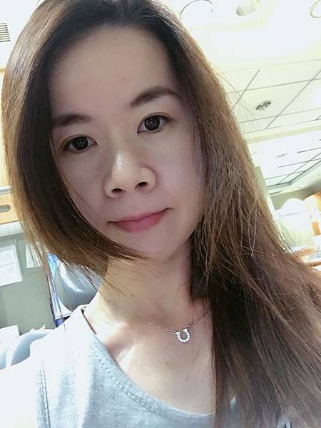 2016-06-18臉頰邊的骨釘好痛苦 2016-06-18臉頰邊的骨釘好痛苦