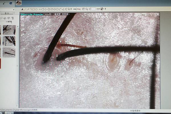 1060906-頭皮養護-31