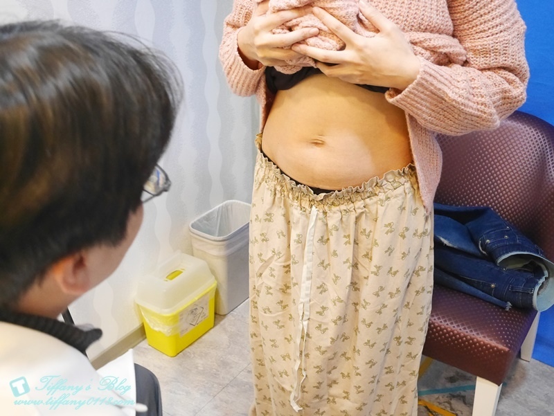 VASER威塑抽脂體驗 - 『醫美‧腹部』威塑抽脂3個月成果!!2.jpg VASER威塑抽脂體驗 - 『醫美‧腹部』威塑抽脂3個月成果!!2.jpg