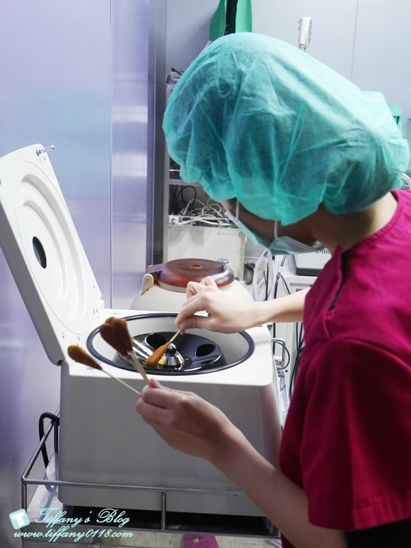 VASER威塑抽脂體驗 - 『醫美‧腹部』威塑抽脂3個月成果!!9.jpg VASER威塑抽脂體驗 - 『醫美‧腹部』威塑抽脂3個月成果!!9.jpg