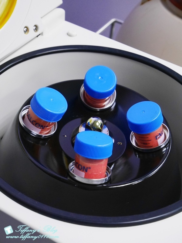 VASER威塑抽脂體驗 - 『醫美‧腹部』威塑抽脂3個月成果!!12.jpg VASER威塑抽脂體驗 - 『醫美‧腹部』威塑抽脂3個月成果!!12.jpg