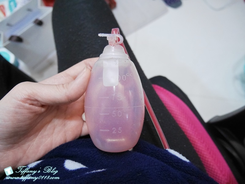 VASER威塑抽脂體驗 - 『醫美‧腹部』威塑抽脂3個月成果!!14.jpg VASER威塑抽脂體驗 - 『醫美‧腹部』威塑抽脂3個月成果!!14.jpg