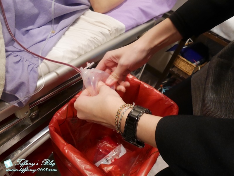 VASER威塑抽脂體驗 - 『醫美‧腹部』威塑抽脂3個月成果!!15.jpg VASER威塑抽脂體驗 - 『醫美‧腹部』威塑抽脂3個月成果!!15.jpg