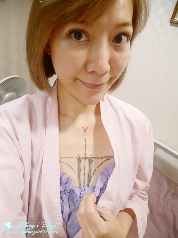 VASER威塑抽脂體驗 - 『醫美‧腹部』威塑抽脂3個月成果!!43.jpg VASER威塑抽脂體驗 - 『醫美‧腹部』威塑抽脂3個月成果!!43.jpg