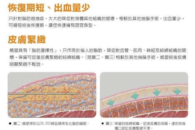 威塑超音波抽脂 - 悄悄的做了威塑瘦手臂跟背 術後五個月心得分享9.jpg