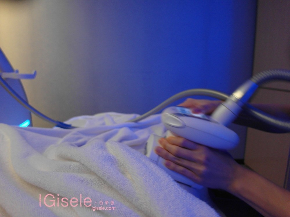 威塑超音波抽脂 - 悄悄的做了威塑瘦手臂跟背 術後五個月心得分享15.jpg 威塑超音波抽脂 - 悄悄的做了威塑瘦手臂跟背 術後五個月心得分享15.jpg