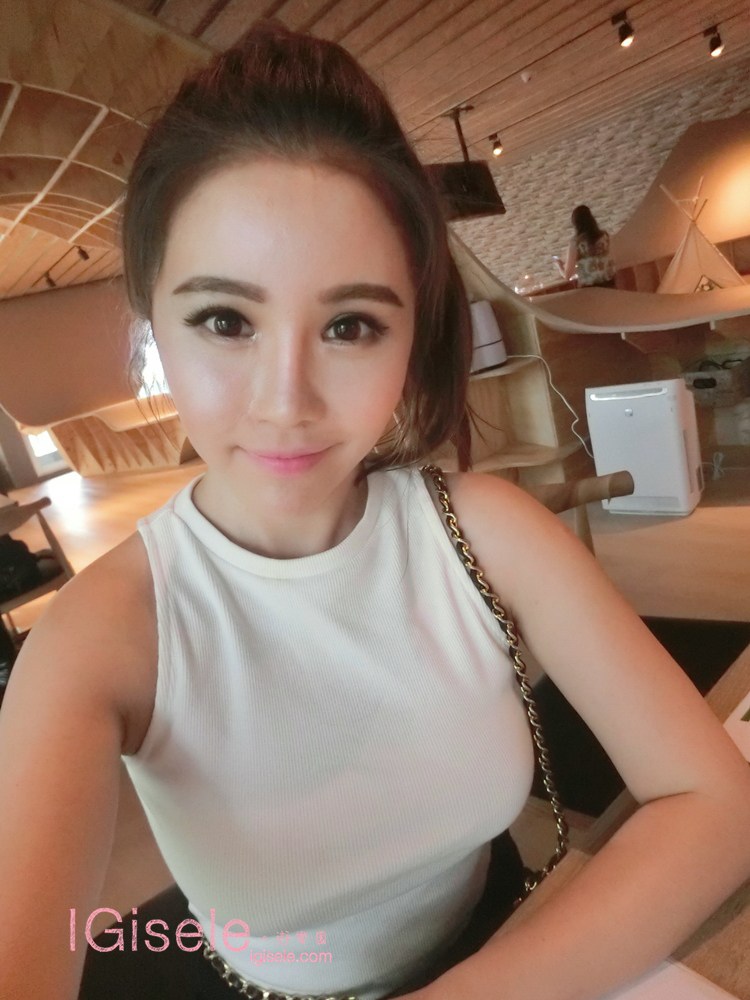 威塑超音波抽脂 - 悄悄的做了威塑瘦手臂跟背 術後五個月心得分享20.jpg 威塑超音波抽脂 - 悄悄的做了威塑瘦手臂跟背 術後五個月心得分享20.jpg