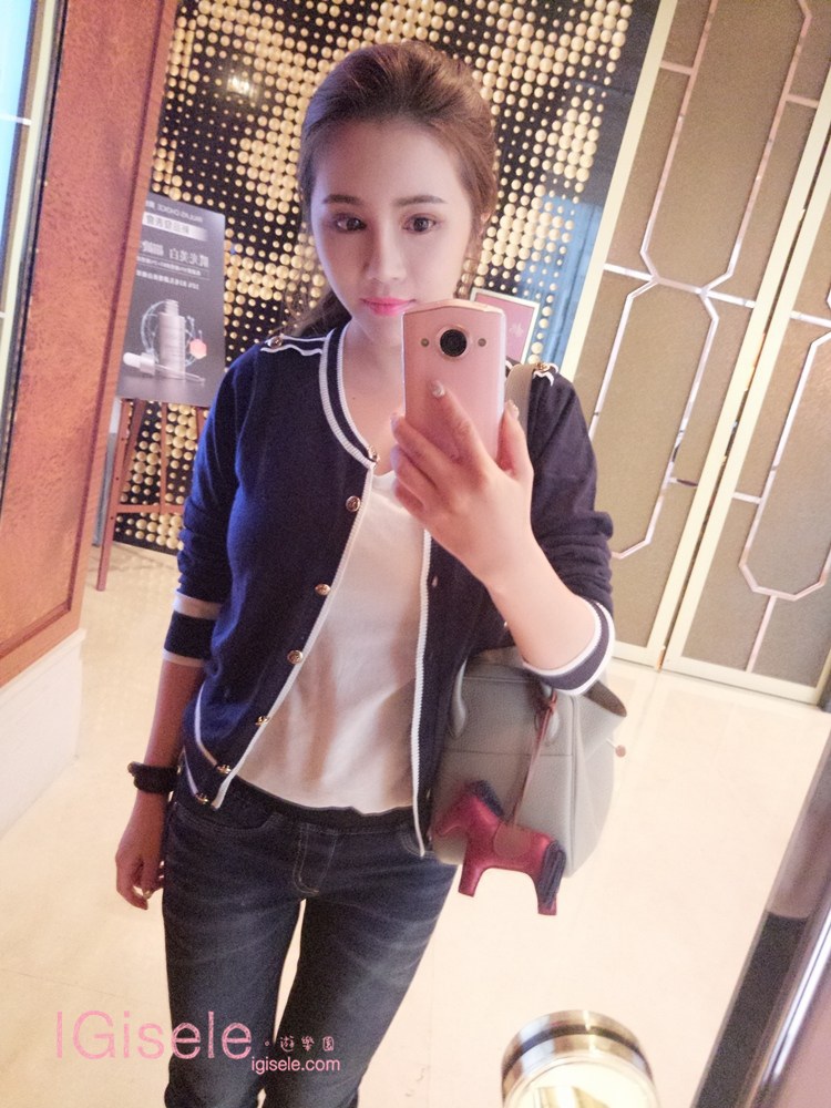 威塑超音波抽脂 - 悄悄的做了威塑瘦手臂跟背 術後五個月心得分享28.jpg 威塑超音波抽脂 - 悄悄的做了威塑瘦手臂跟背 術後五個月心得分享28.jpg