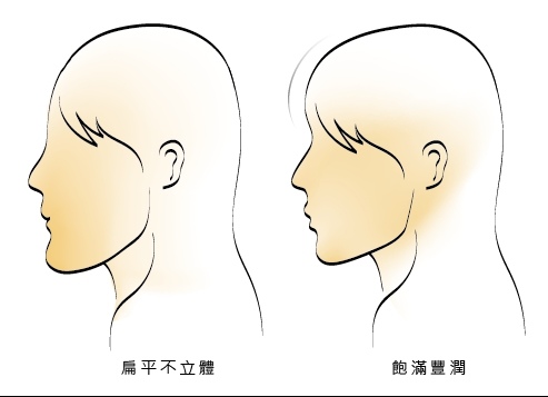 玻尿酸體驗 - 美女【喬言愛】Hyadermis海德密絲豐額6.jpg 玻尿酸體驗 - 美女【喬言愛】Hyadermis海德密絲豐額6.jpg